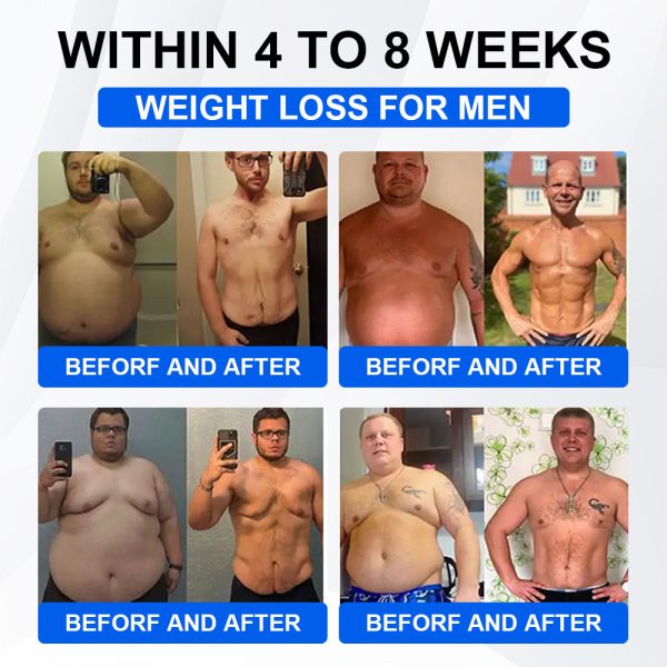 🔥Official Store🔥 | LBMLBM® SMGT-GLP-1 Nano Microneedle Patch with Collagen & Motrixyl 3000 | Targeting Obesity, Cardiovascular Disease, Diabetes, Sleep Apnea, Joint Issues & More