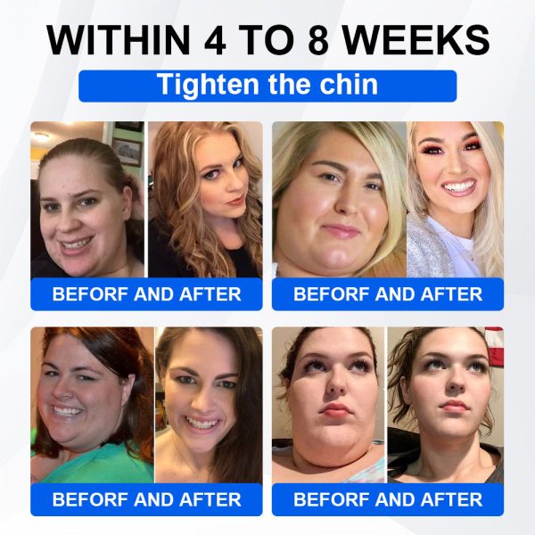 🔥Official Store🔥 | LBMLBM® SMGT-GLP-1 Nano Microneedle Patch with Collagen & Motrixyl 3000 | Targeting Obesity, Cardiovascular Disease, Diabetes, Sleep Apnea, Joint Issues & More