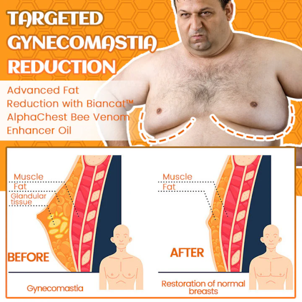 ✨BBOJI™ ThermoFirm Bees Gynecomastia Oil