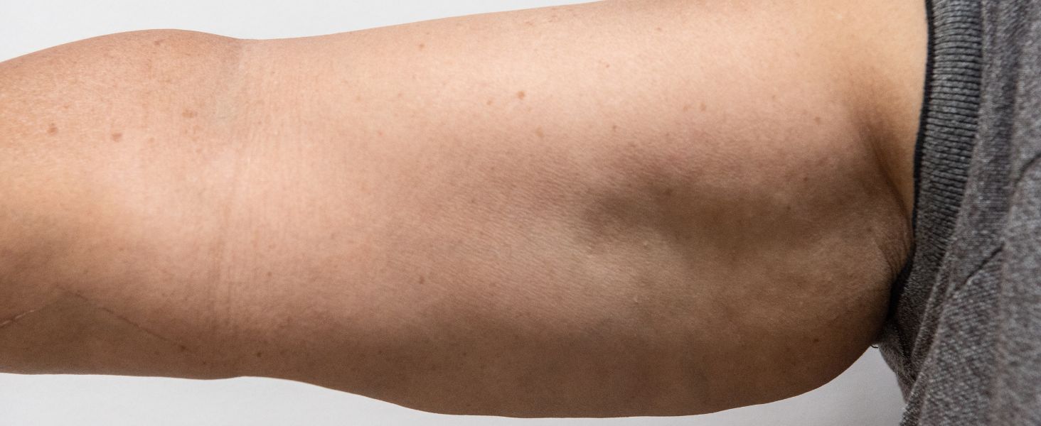 detox cleanse weight management